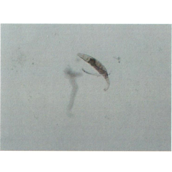 ゼンスイ バクテリアホールド Mサイズ(15Φ) 50L 代引不可 同梱不可 送料無料 北海道 ・沖縄・離島 別途見積